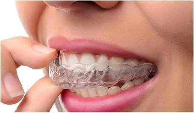 Braces & Invisible Aligners in Noida